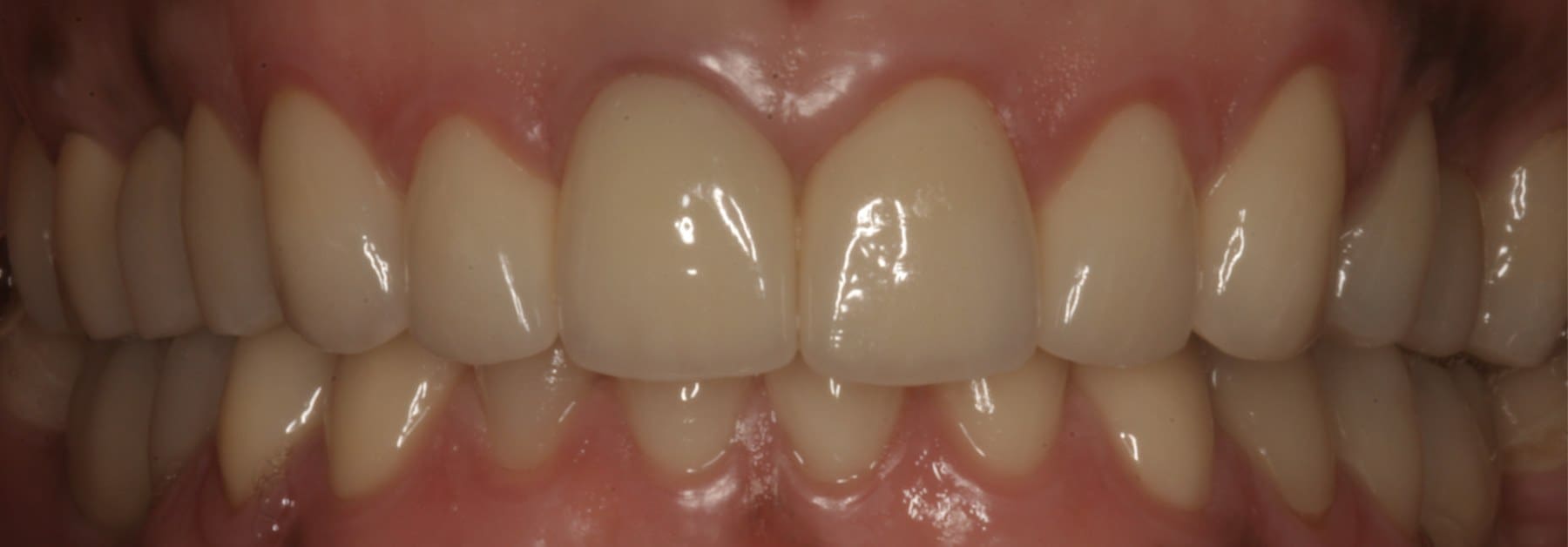 After dental treatment example