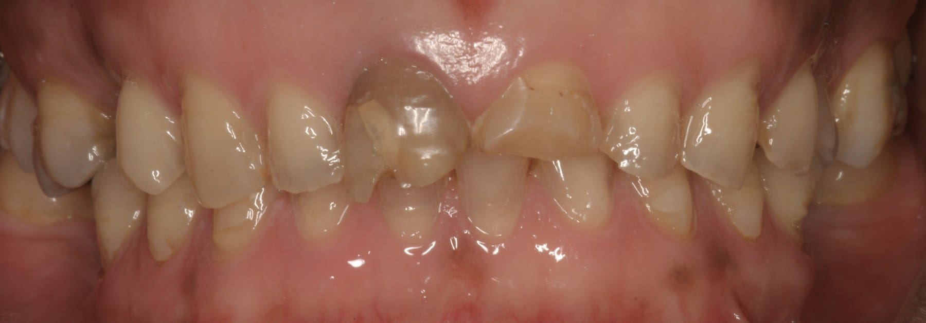 Before dental treatment example